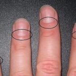 Nail Lunes: How They Relate to Health ➤ haberion.com
