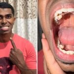 A Malaysian man was found to have 42 teeth—ten more than the average person ➤ haberion.com