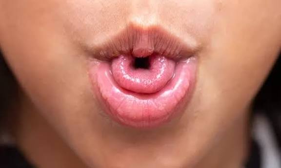 Savez-vous rouler votre langue en forme de « U » ? Voici ce qui se cache réellement derrière cette capacité singulière